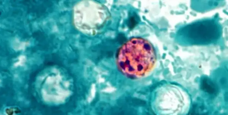 Cyclosporiasis outbreak: Michigan cases jump to over 2,600