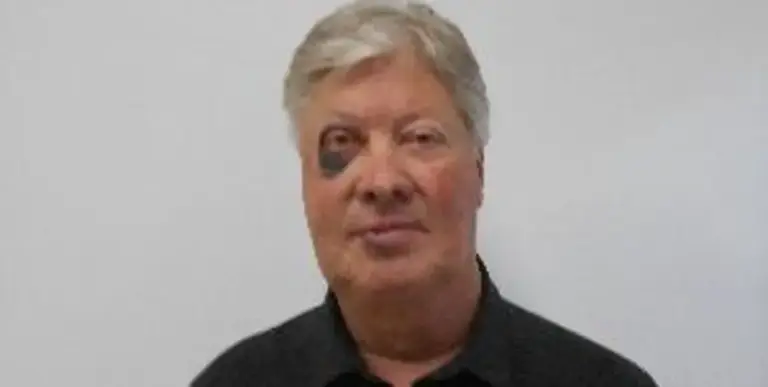 Former Gateway pastor Robert Morris’ sex offender photo features black eye