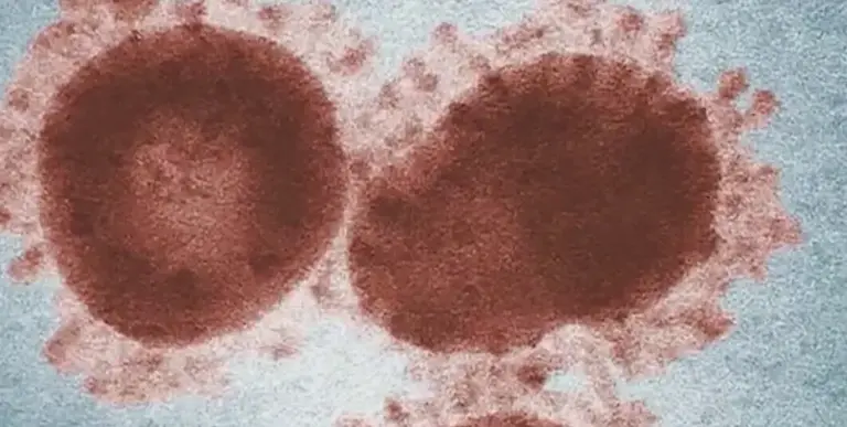 UT study looks at human antibody response to COVID-19